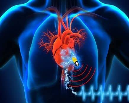 How Pacemaker Implant? | Best Pacemaker implantation in Indore | Top Cardiologist in Indore